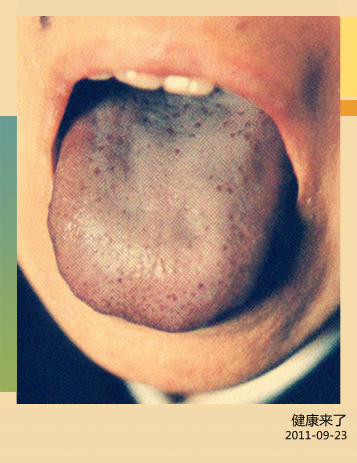2011-9-22 <wbr>董宜华：看舌头知健康（上）