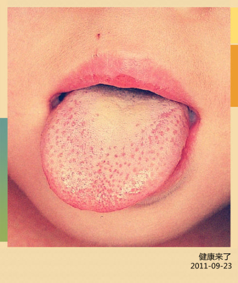 2011-9-22 <wbr>董宜华：看舌头知健康（上）