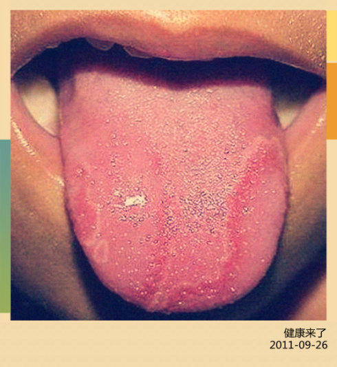 2011-9-23 <wbr>董宜华：看舌头知健康（下）