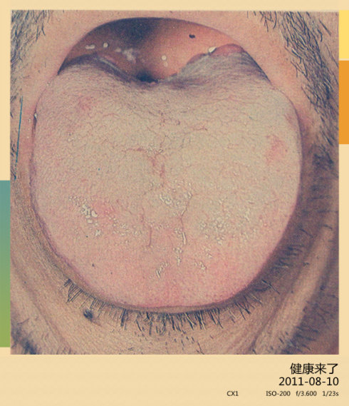 2011-9-23 <wbr>董宜华：看舌头知健康（下）